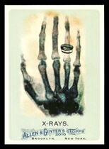 2010 Topps Allen & Ginter #185 X-Rays